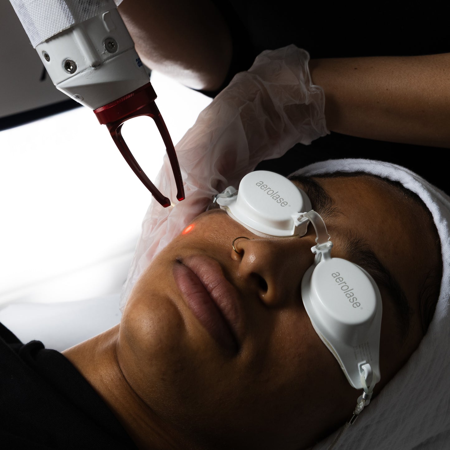 Neo - Pigmentation / Melasma