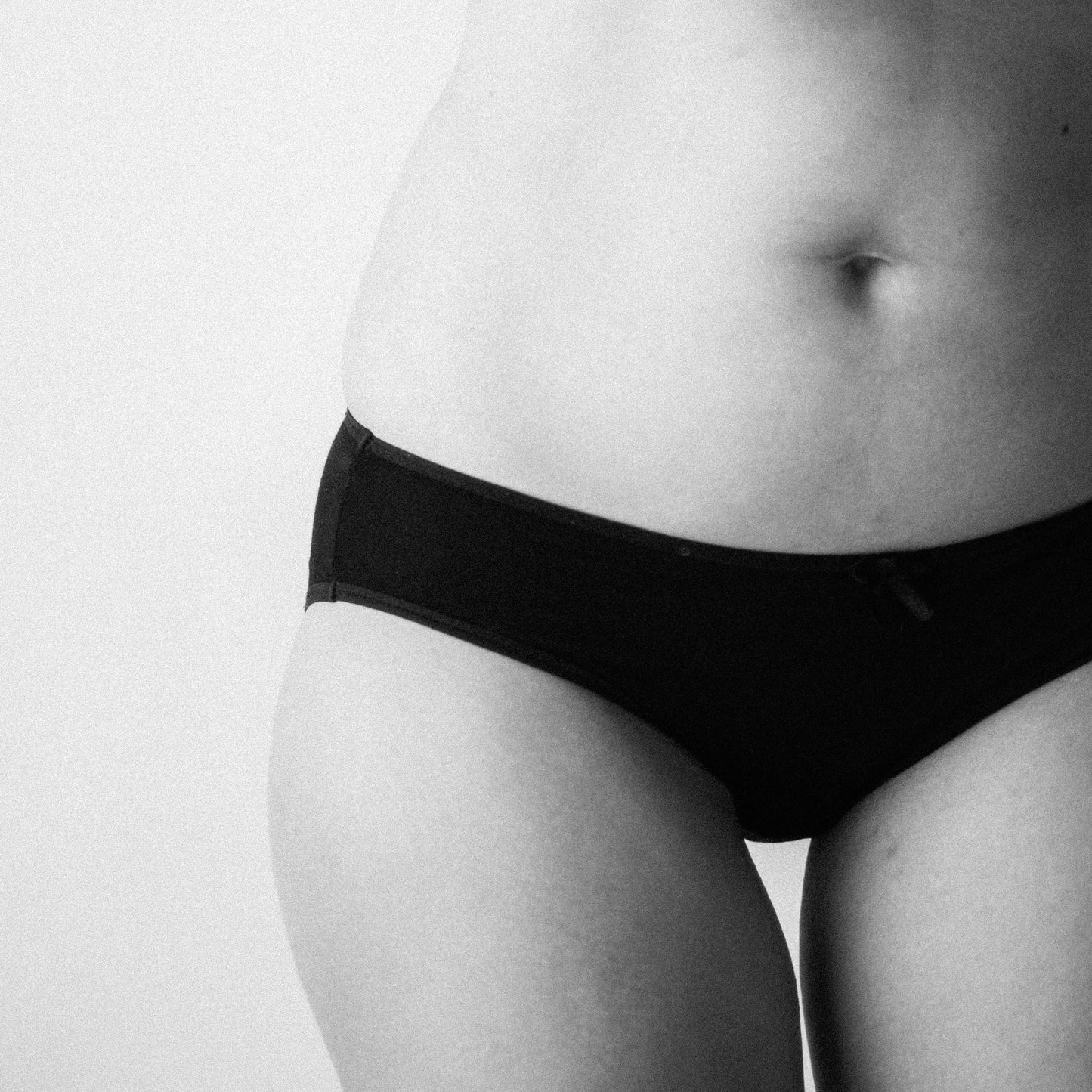 Bikini Laser Hair Reduction