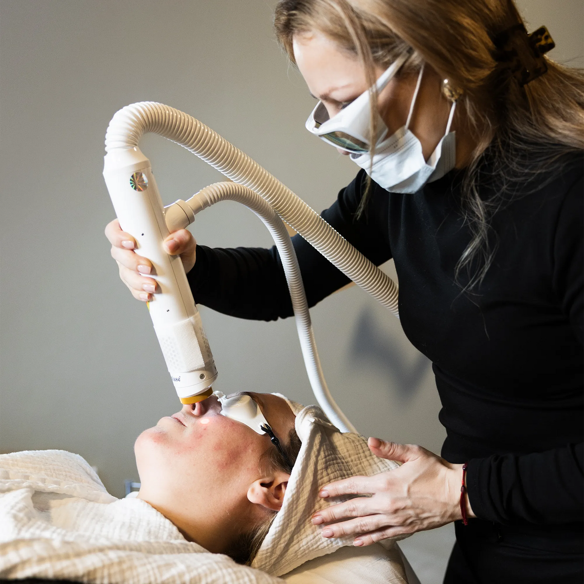 Aerolase Rosacea Treatment