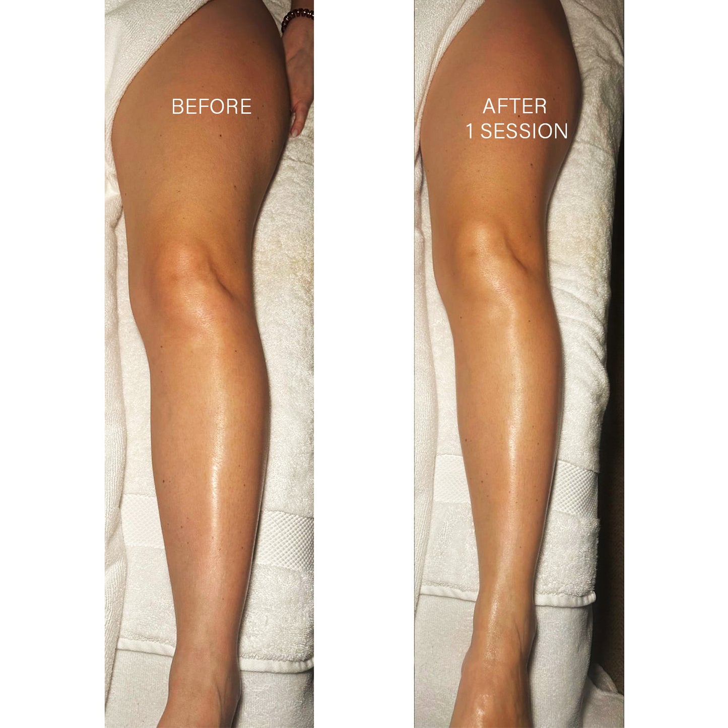 Brazilian Lymphatic Drainage