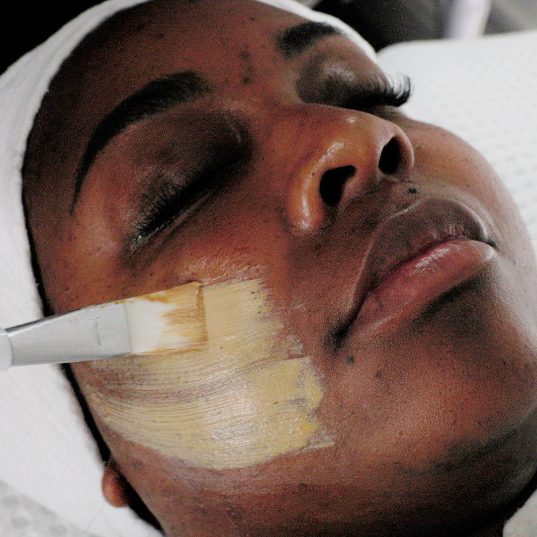 Cosmelan Peel