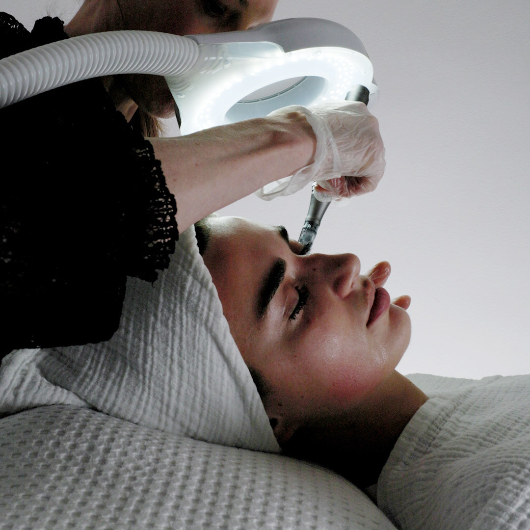 Signature Microneedling Facial