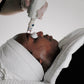 Eyebrow Tattoo Removal