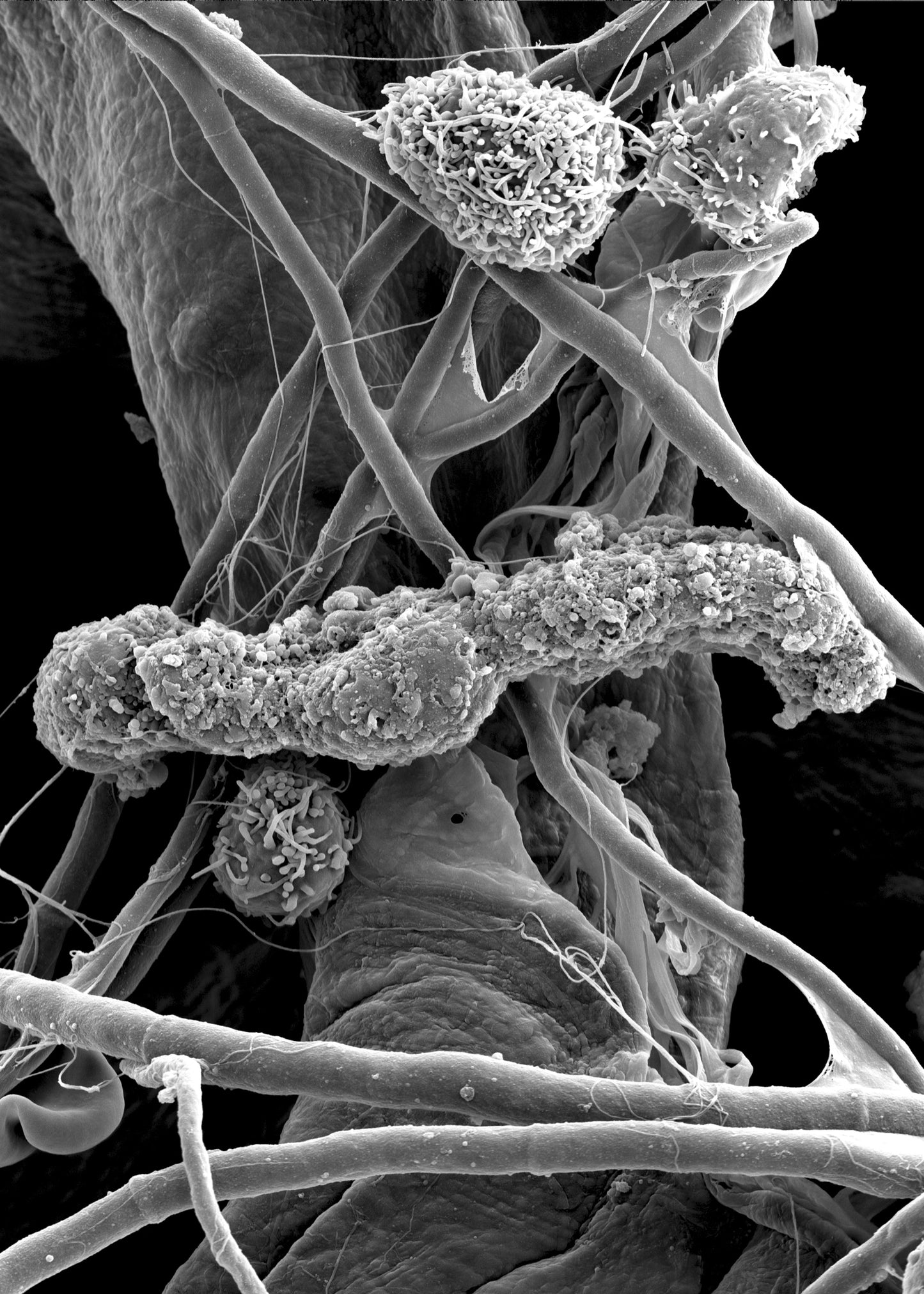 microscopic view of blood. Advanced Well Person Blood Test. Biochemical tests at Teresa Tarmey Clinic